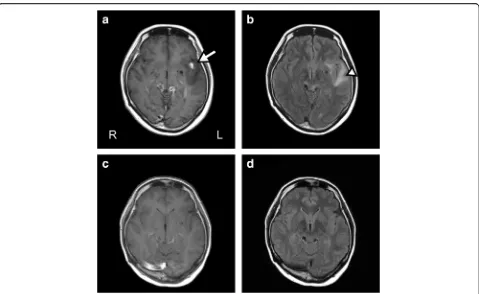 Fig. 2 Temopral changes of the brain MRI after PR. a, Contrast-enhanced axial T1-weighted brain MRI revealed tuberculomas (arrow) with a diffusehypointense area around the left sylvian fissure