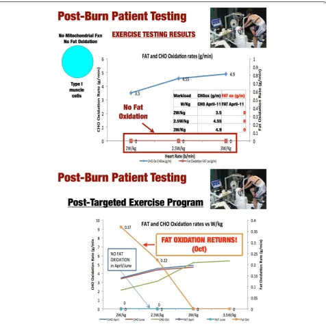Figure 7 A - Exercise Physiology Testing in Burn Patient Prior to Metabolic and Exercise Therapy