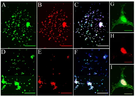 Figure 4 Internalization of hPNP-induced permeation of propidium iodide in primary cochlear cell culture