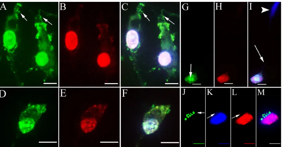 Figure 6 A hPNP vesicle pathway from the cytoplasm towards the nucleolin-positive nucleolus was observed in the primary cochlear cell culture exposed to hPNPs (arrows in A and C)