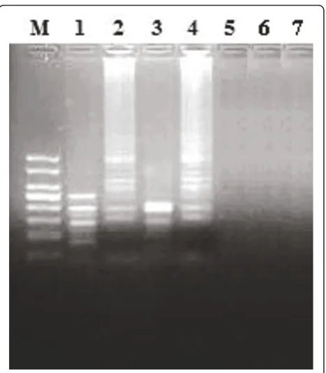 Figure 3 GoldView staining of the samples. Samples with thefluorescence change from orange to green under UV lamp at a 254nm are considered as positive (Lanes 2 and 3), while a sample withfluorescence change from orange to red is considered as negative(Lane 1).