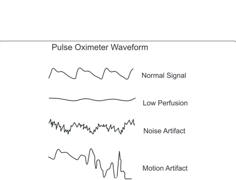 Fig. 1 Transmitted light absorbance spectra of four hemoglobin species: oxyhemoglobin, reduced hemoglobin, carboxyhemoglobin,and methemoglobin