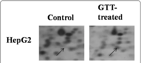 Figure 4 Enlargement of Prx4 (spot A) without (control) andwith GTT treatment of HepG2 cells in 2DE gel.