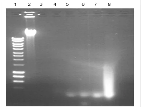 Figure 2 Digestion of human blood DNA with micrococcalnuclease at different concentration of ox bile