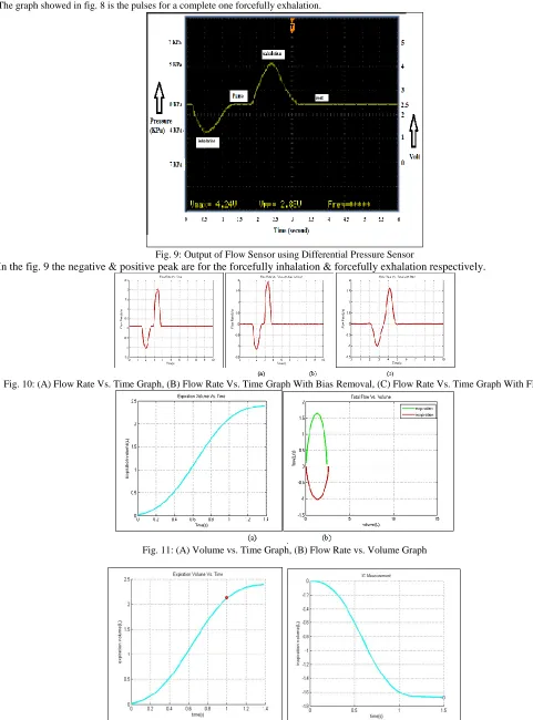 Fig. 9: Output of Flow Sensor using Differential Pressure Sensor In the fig. 9 the negative & positive peak are for the forcefully inhalation & forcefully exhalation respectively