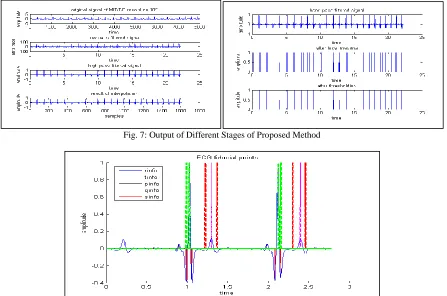Fig. 6: Output Of Implemented Existing Methods: A) EMD B) Wavelet Transform Method C) Pan-Tompkins Method D) Successive  Differentiation Method