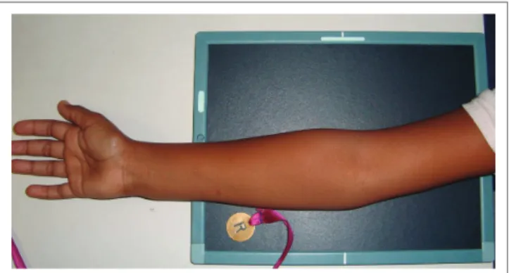 FIGURE 1: Positioning for the anteroposterior (AP) projection. The elbow should  be in contact with and in the middle of the cassette in full extension with the  forearm supinated.