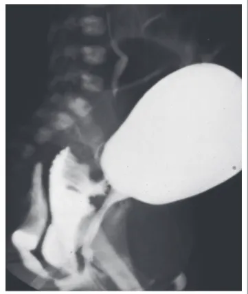 FIGURE 12: Lateral radiograph during cloacogram.