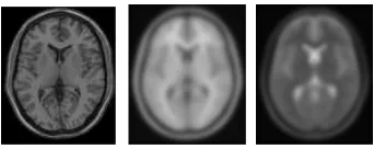 Figure 4. Spatial priors used in registration. Left to right: an exampleslice of each of the Colin Holmes template [13], and ICBM T1 and T2