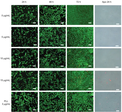 Figure 5 LIVE/DEAD® viability/cytotoxicity assay and early apoptotic detection (annexin V-FITC/PI assay) performed for different incubation times and concentrations.Note: Scale bar: 100 µm.
