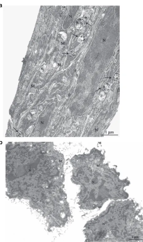 Figure 3 TEM imaging of C2C12 cells incubated for 12 h with (a) and without (b) a 10 µg/mL BNNT modified medium