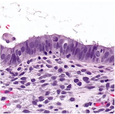 Fig 4: Endometrium showing functional layer and basal layer. (Wikipedia) 