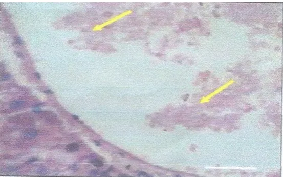 Fig. 2 Thin blood film smear showing red cells of P.berghei infected and treated with ethanol extract of Phyllantus amarustreated at day 4