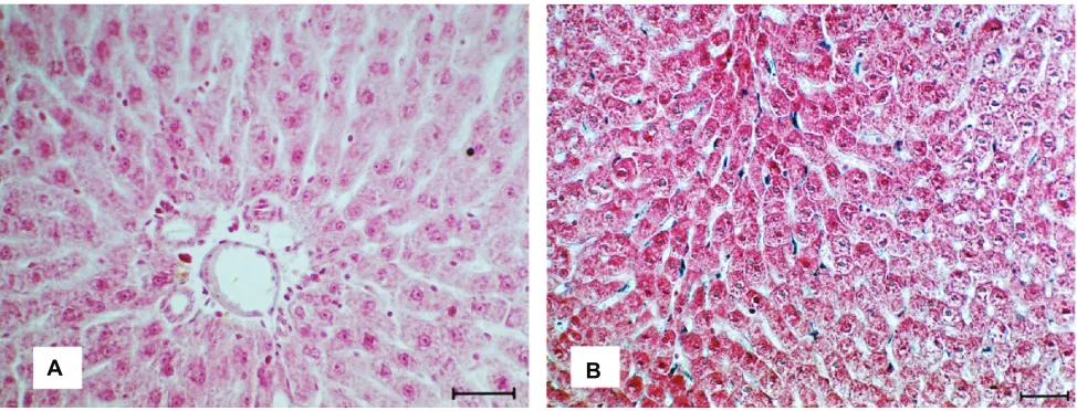 Figure 3 A) Micrograph of liver colored by the Prussian blue from tissues of control animals