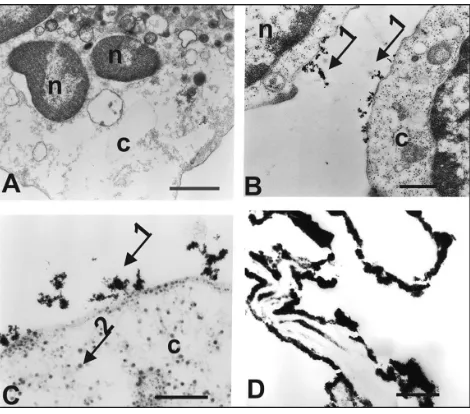 Figure 5 FMR spectra showing the derivative of the absorption of the sPIONs of Fe3O4, labeled cells, not labeled cells, and the 0.5% glutaraldehyde fixator.Abbreviations: FMR, ferromagnetic resonance; sPIONs, superparamagnetic iron oxide nanoparticles.