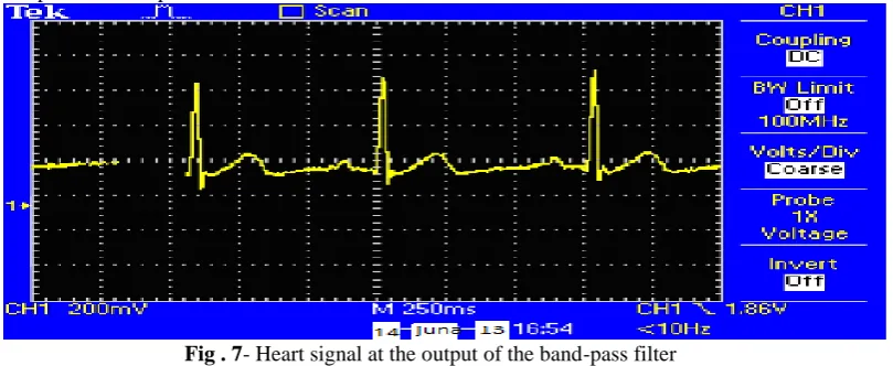 Figure 7 shows the heart signal at the output of the passive band-pass filter. The noise present in the signal has been reduced; however, the peak-to-peak amplitude has been also attenuated due to filter effects
