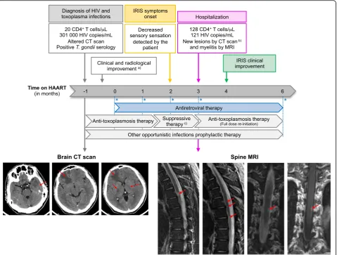 Fig. 1 CNS-IRIS case timeline. On top, a timeline of the clinical evolution shows the temporal relation between toxoplasmosis CNS-IRIS symptoms(collected for flow cytometry analysis