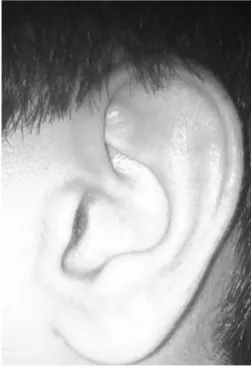 Figure 3 shows an image which conserves the outer shape of the Ear.  
