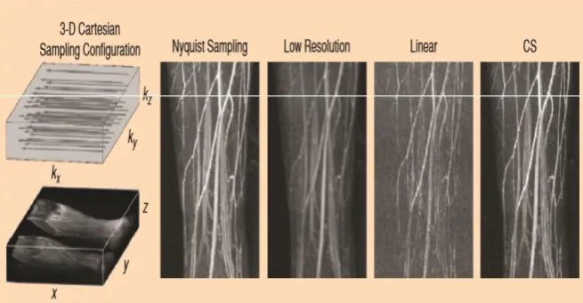 Figure 1: MRI image reconstructed using various techniques.[6] 