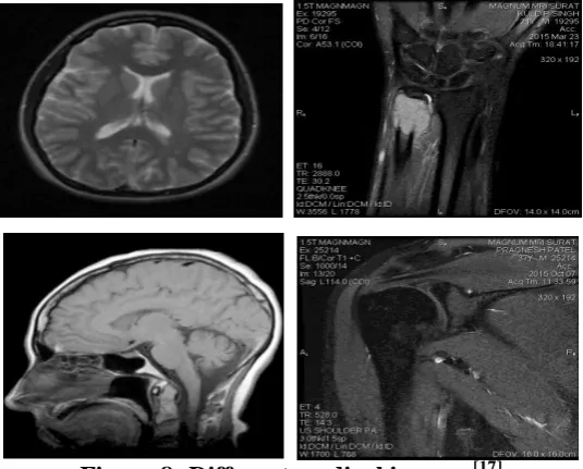 Figure 8: Different medical images.  [17] 