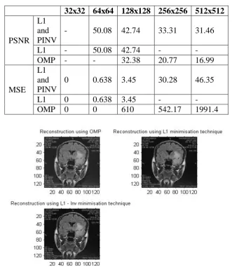 Table 1: MSE and PSNR values comparison for different medical images for 50 iteration