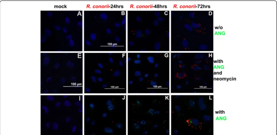 Figure 3 SFG rickettsial infection initiated compartmentalized translocation of exogenous rANG in human primary endothelial cells.exogenous rANG in SFG rickettsiae-infected endothelial cells (imagestriggered compartmentalized translocation of exogenous rAN