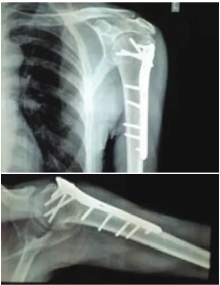Fig. 7 X-ray shoulder joint, A-P and axial views.