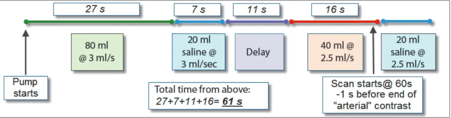 Fig. 1. Injection plan.