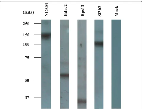 Figure 3 Western blot analysis of proteins expression in total extracts of 293T cells transfected with the pcDNA3.1 (+) expressionplasmid