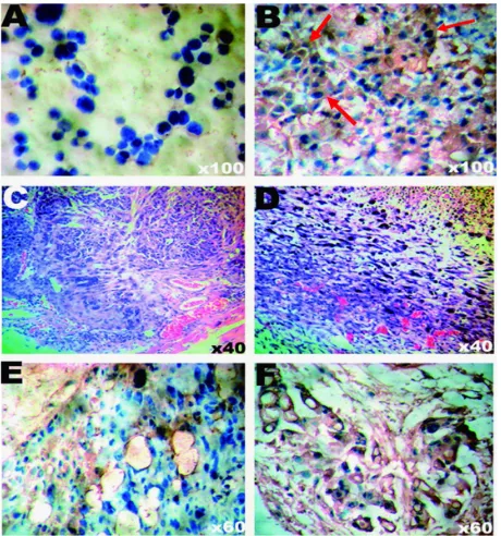Figure 4 he and sP staining of tumor cells  (A, B) or tumor tissues (C–F).  The different expression patterns of αvβ3 integrin were shown by sP staining