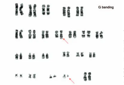 Figure 6. Meiotic Cell Division Emphasizing Chromosome Movement 