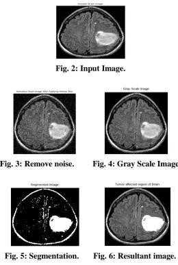 Fig. 2: Input Image. 