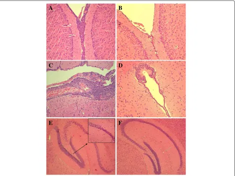 Figure 3 Brain histology of mice infected with TIGR4 or FP23.fibrin is clearly visible in the ventricular spacecompared