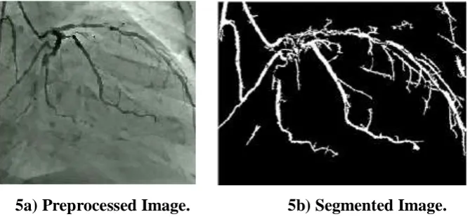 Fig. 5: Segmentation Result. 