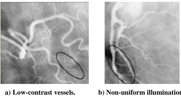Fig. 1: Angiography images with typical hindrances. 