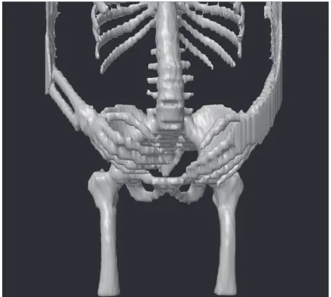 Figure 1 Attempt to automatically extract bone information from the VisibleHuman dataset (NIH) using the equidensity approach