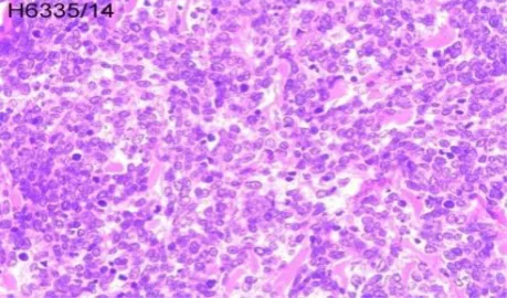 Figure 1. Ulcero-proliferative growth