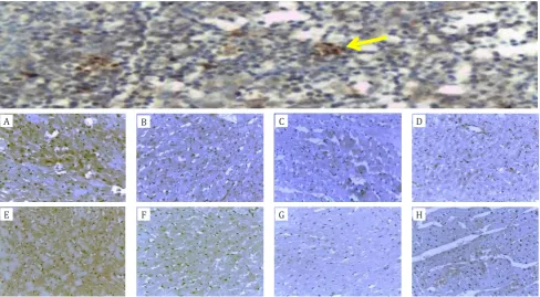 Figure 1.  diomyocytes) in: A. Exc-4;  B. Exc-4-D; E. Exc-12, and F. Exc-12-D. There is a decrease in the percentage area of caspase-3 expression      Increase in the percentage area of the expression of caspase-3 (brown in the cytoplasm of rat cardiac lef