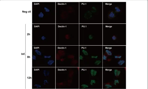 Fig. 2 Immunofluorescence staining for Dectin-1 and PU.1 expression and location inanti-Dectin-1 and rabbit anti-PU.1 antibodies at a 1:100 dilution, stained with Alexa Fluor-568 donkey anti-goat IgG and Alexa Fluor-488 donkey anti-rabbit A