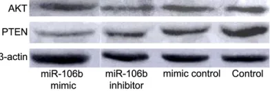 Figure 2. Transwell assay of invasion and migration of MCF-7 cells. A: miRNA-106b mimic, invasion; B: miRNA-106b mimic, migration; C: miRNA-106b inhibitor, invasion; D: miRNA-106b inhibitor, migration; E: Mimic control invasion; F: Mimic control, migration; G: Control, invasion; H: Control, migration.