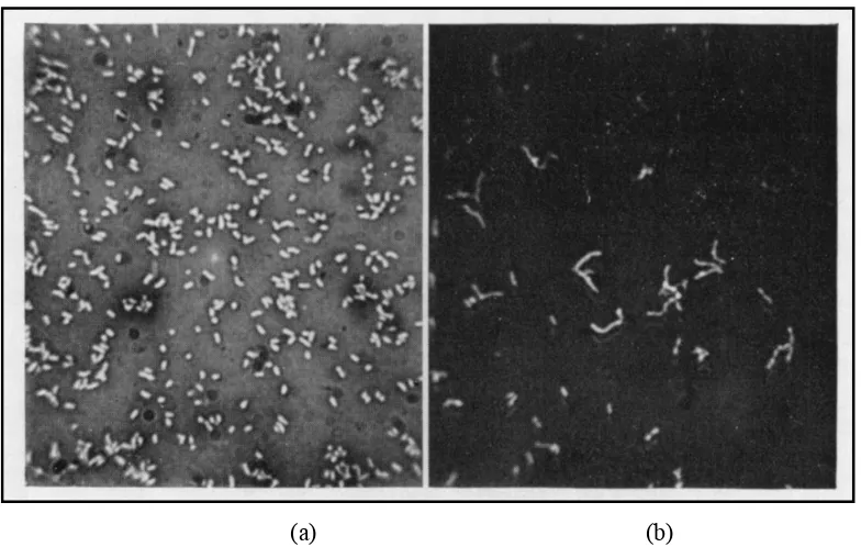 Figure 2.4 Negative stains of four days old slant cultures incubated (a) anaerobically and (b) aerobically (Douglas and Gunter, 1946) 