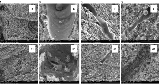 Figure 1. Changes in cerebral microvessels in the standard diet group (a-d) fibers binding together in the capillary lumen (c1 versus the HFD group (a1-d1)
