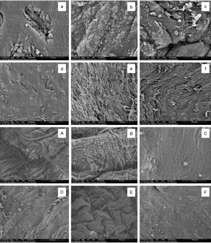 Figure 2. The changes to the cerebral vascular surface on different rat chows. The HFD group (a-f) versus the standard diet (A-F) under different magnification (×800: a-c, A-C; ×500: d-f, D-F)