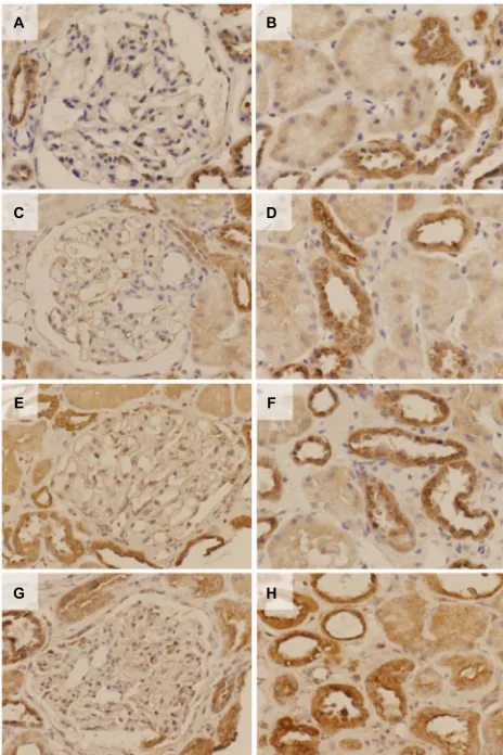 Figure S2 Immunohistochemical analysis for semaphorin3A in the glomerulus and renal tubules for each nephropathy.Notes: (A, C, E, G) Glomerulus, (B, D, F, H) tubules