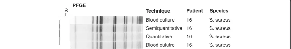 Figure 3 Dendrogram generated by Dice/UPGMA analysis (Bionumerics, Applied Maths) ofisolated from catheters by semi-quantitative and quantitative culture and from blood cultures of confirmed cases of catheter-relatedbloodstream infection (similarity SmaI P