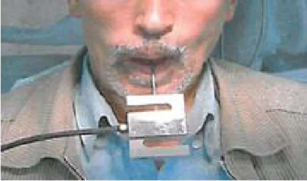 Figure 2. Measuring the load required for   dislodgment of the maxillary denture base 