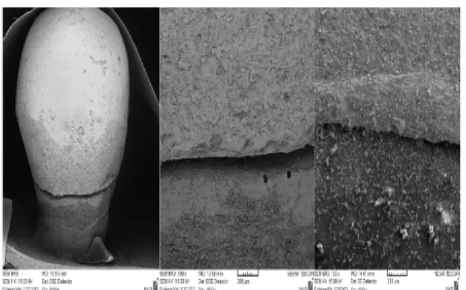 Figure 5. Assessment of the marginal fit of restorations  before cementation under a SEM 