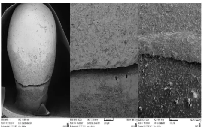 Figure 5. Assessment of the marginal fit of restorations  before cementation under a SEM 