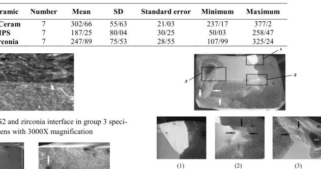 Figure 5. IPS2 and zirconia interface in group 3 speci- speci-mens with 3000X magnification 