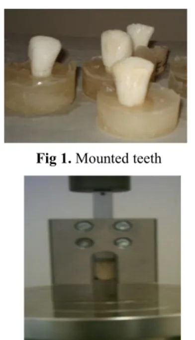 Fig 1. Mounted teeth 